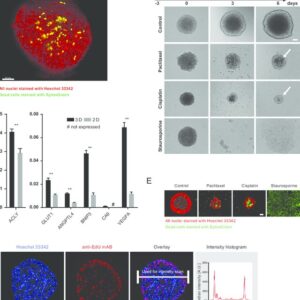 Multicellular tumor spheroids