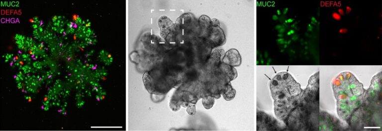 organoids